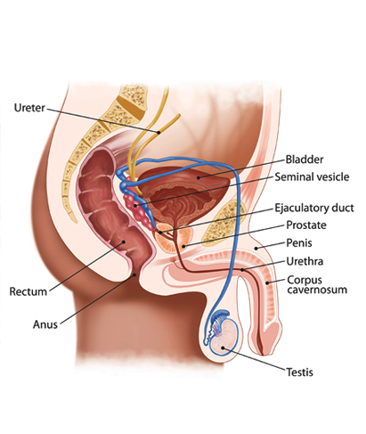 prostate-cancer